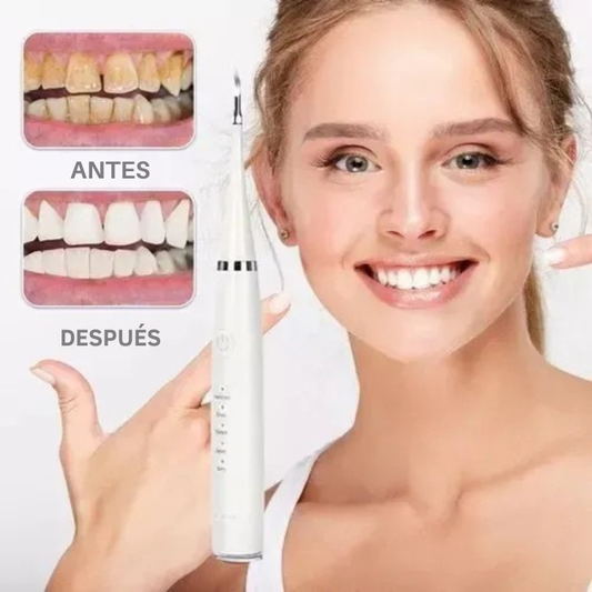 Limpiador Dental Quita Sarro Bucal -